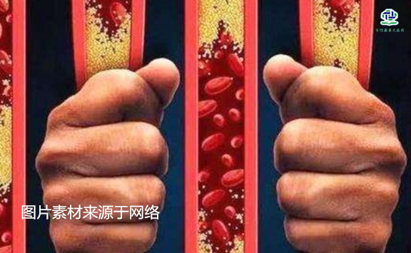 不想給血管“添堵”，盡量少吃以下這些東西，或許能讓腦梗離遠些  